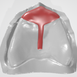 Dental-T-Spacer-1.png ESPACIADOR DENTAL COLECCIÓN 1