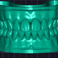 2022-05-20_00001-001_DentalCadScreenshot4.png STL-Datei Zahnmodelle und Zahnkronen・Vorlage für 3D-Druck zum herunterladen