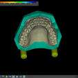 Captura-de-pantalla-50.png UPPER & LOWER TEETH