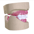 7.png Digital Full Dentures with Combined Glue-in Teeth Arch