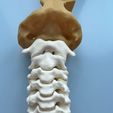 model-4.jpeg Archivo STL El modelo de la columna cervical C1-C7 con una parte del cráneo・Modelo para descargar y imprimir en 3D