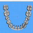 Dentes-Mandibula-Robtoly-Unique-Exocad-02.jpg Teeth Lower Jaw - Exocad - Robtoly-Unique