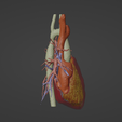 4.png 3D Model of Human Heart with Atrio-Ventricular Septal Defect (AVSD) - generated from real patient