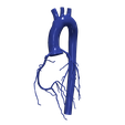 8.png 3D Model of Aorta and Coronary Arteries