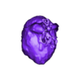 Tetrology of Fallot.stl 先天性心脏病分类（CHD）
