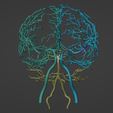 22.png 3D Model of Brain and Aneurysm
