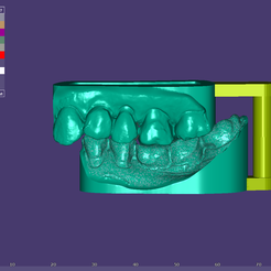 1.png DENTAL INLAY WITH MODEL