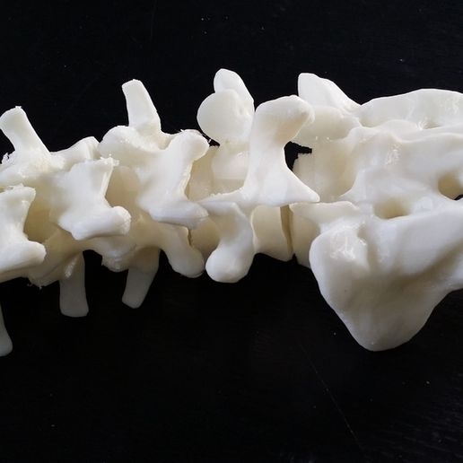 20150419_173557.jpg Поясничные позвонки и крестец, в удобном формате для печати