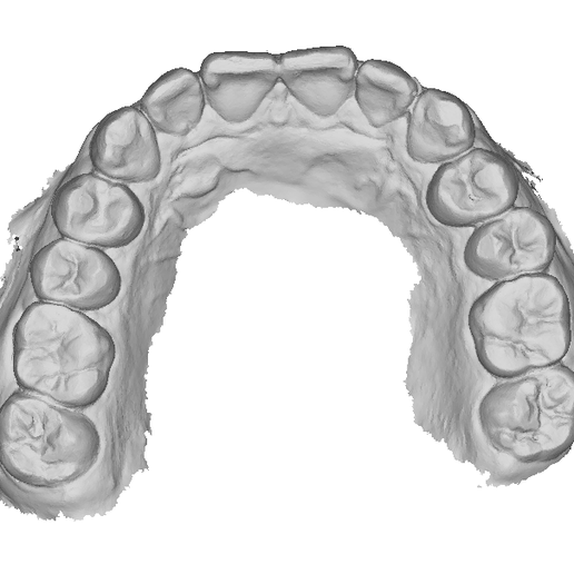 🩻 P003 - Dental - Intraoral Scan STL-PLY-OBJ 3D print model・ STL File ...