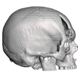 Captura-de-Pantalla-2023-08-22-a-la-s-6.38.16-p. m.png skull fracture / skull fracture