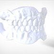 Screenshot_15.png Digital Try-in Full Dentures for Injection Molding