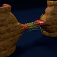 as5.jpg 3D Angiogenesis NEW BLOOD VESSEL FORMATION