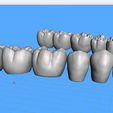 Dentes-Mandibula-Ashortia-Exocad-03.jpg Teeth mandibule - Ashortia - Exocad