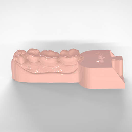 Screenshot_4.png Digital Quadrant Model with 3Shape Articulator Interfaces