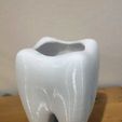 backenzahnbecher_01.jpg Molar cup