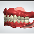 25.png Digital Full Dentures with Combined Glue-in Teeth Arch