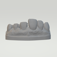 2.png DENTAL VENEER TRAINING MODEL