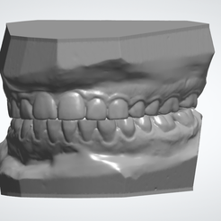 Screenshot-2024-05-23-161647.png Dental Study Models
