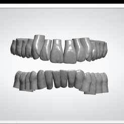 File View Help Vertices: 314653 Facets: 629187 3shape> \S en 18q STL file library of teeth・Model to download and 3D print