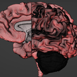 11.png 3D Model of Brain - section