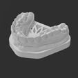 3.png BASES FOR DENTAL 3D PRINTED MODELS - BASES PARA MODELOS ODONTOLÓGICO IMPRESSOS 3D