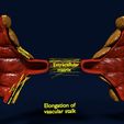 ps9.jpg 3D Angiogenesis NEW BLOOD VESSEL FORMATION