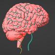 2.png 3D Model of Brain and Aneurysm