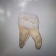IMG_20220920_155924.jpg 2x real, tooth, tooth 3dscan 15 and 17