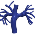 chd2.png.3b5587f083fb6e06b838e0cdeaab0f28.png 3D Model of Pulmonary Arteries (Fontan Procedure)