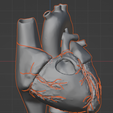 2.png 3D Model of Heart with Tetralogy of Fallot (ToF)