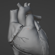 5.png 3D Heart Anatomy with Codominance