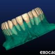photo_7_2023-09-16_16-48-19.jpg Phantom dental model for dental technicians