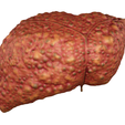 cirrhosis_001-2.png Anatomical model of the liver with cirrhosis