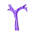 STL- aatracheatrachea.stl 3D Model of Double Aortic Arch