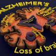 ps10.jpg Alzheimer Disease Brain coronal slice