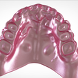 Screenshot_13.png Digital Full Dentures for Gluedin Teeth with Manual Reduction