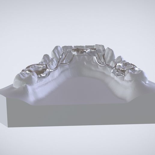 Snapshot_2017-3-1_13-5-51.jpg Digital Dr. Williams's Ortho Appliance