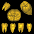 Untitled3.png STL file Mandibular First Molar Anatomy・Model to download and 3D print