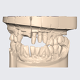 Captura-de-pantalla-2024-02-25-121303.png UPPER AND LOWER ARTICULATED DENTAL MODEL (15)