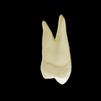 12.png First Upper Left First Premolar #24