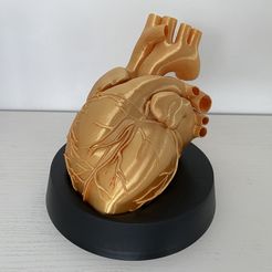 The golden heart