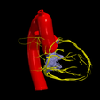23.png 3D Model of Heart with Tetralogy of Fallot (ToF)