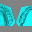 DENISSE-CAMACHO1.jpg Dental Model/ Dental Model