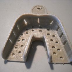 DSCN0321.JPG Free STL file dental impression tray lower M・Model to download and 3D print