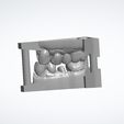 Clipboard-2024-06-11-14-06-32.jpg 10 DENTAL STUDY MODELS - REAL PATIENTS, UPPER AND LOWER 3D MODELS WITH ADDITIONAL DIES