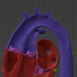5.png 3D Model of Heart with Transposition of the Great Arteries, long axis view