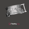 Dental-Articulation-Pins-teethy.org.png Pinos de Articulação Dentária