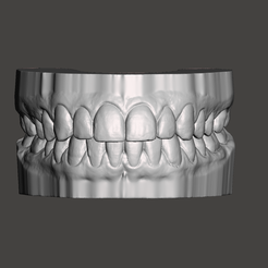 1.png Archivo STL Modelo dental, boca , dientes・Idea de impresión 3D para descargar