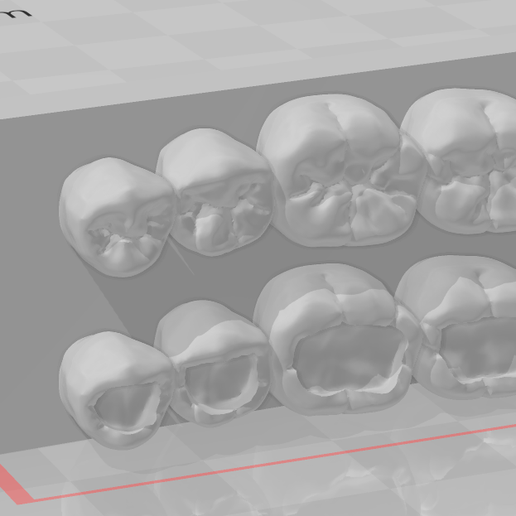 Mndibula-2.png Modelo de Formação Dentária Restauração (Mandíbula)/Modelo de Entrenamiento Dental Restauración (Mandíbula)