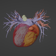 7.png 3D Model of Human Heart with Pulmonary Artery Sling (PAS) - generated from real patient